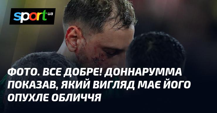 Зображення. Все гаразд! Доннарумма продемонстрував, як виглядає його набрякле обличчя.